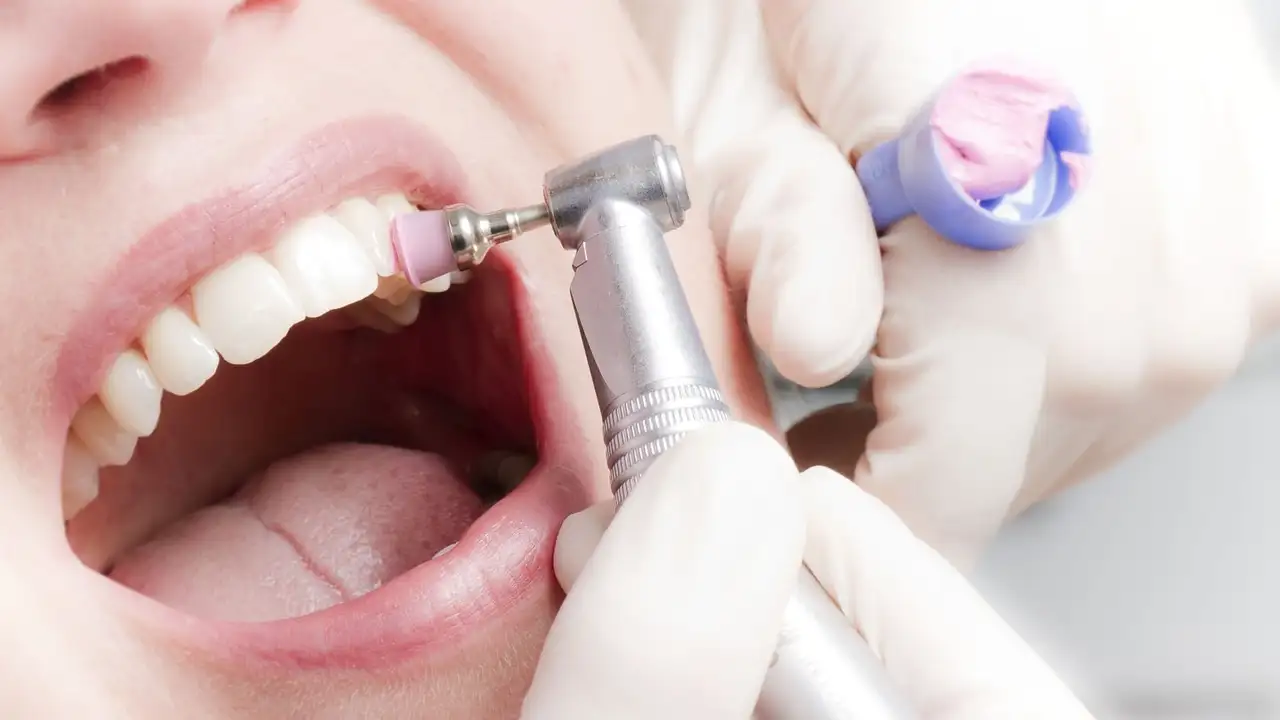 Jak dlouho trvá trhání zubů a co očekávat při zákroku?