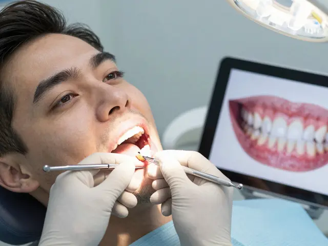 Fazety na zuby: Co o nich říkají zubní lékaři?