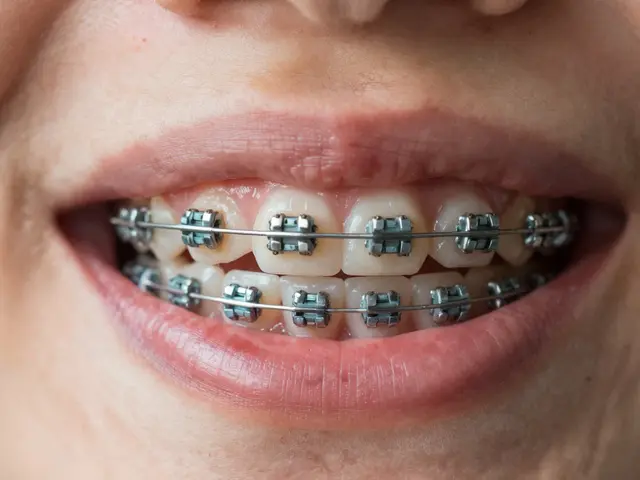 Keramická rovnátka: Jak se vyhnout častým návštěvám zubní hygienistky