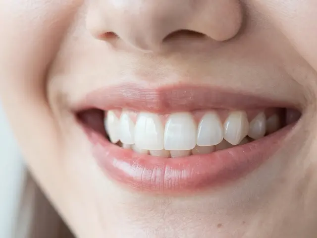 Jak se starat o kompozitní fazety: Kompletní průvodce pro dlouhotrvající úsměv